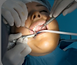 Dentista em Vinhedo